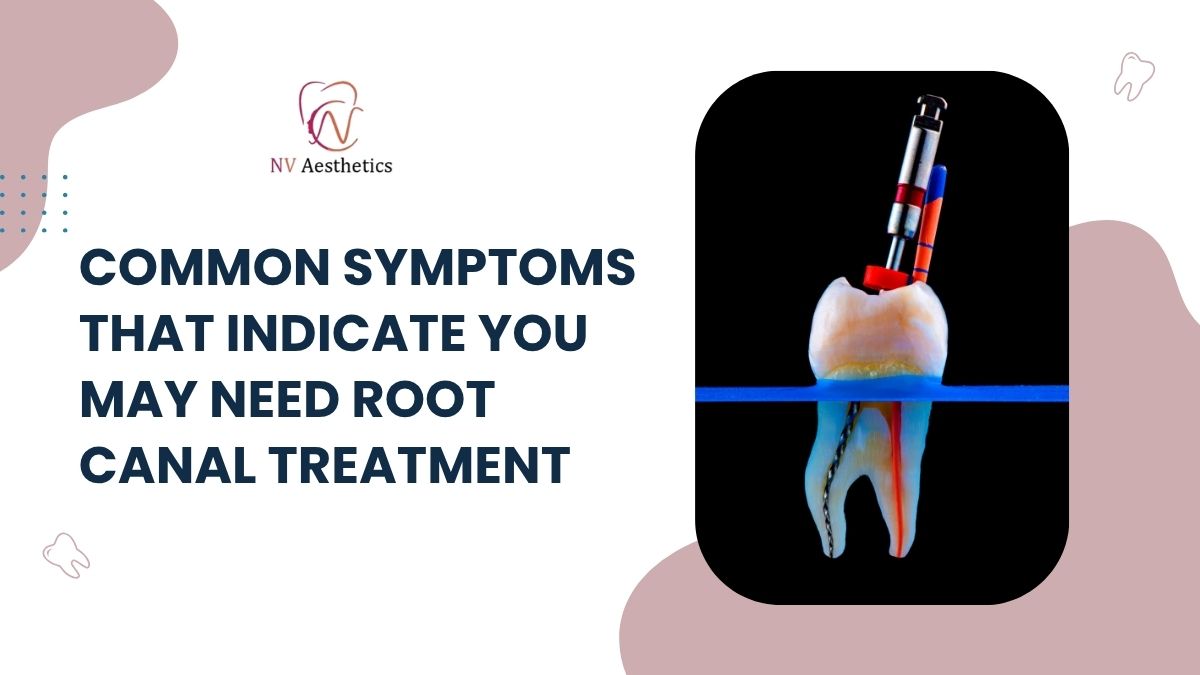 Common Symptoms That Indicate You May Need Root Canal Treatment